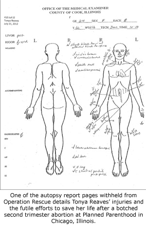 Forensic body chart. Courtesy of King County Medical Examiner's Office